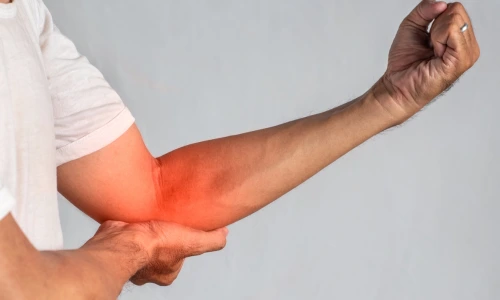 Tennis Elbow