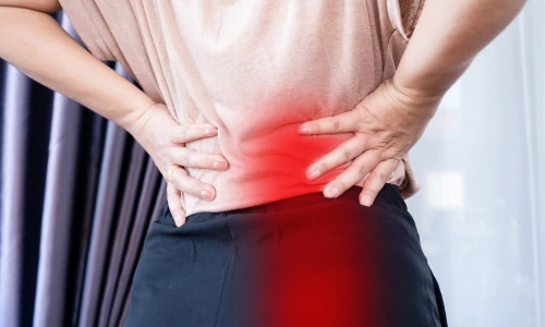 Sciatica