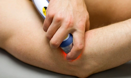 Laser Therapy
